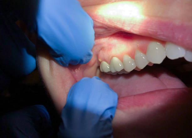 Best Dentist for Dental Trauma  in Alexandria, VA
