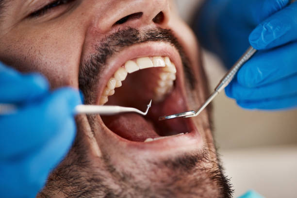 Best Emergency Gum Pain Relief  in Alexandria, VA