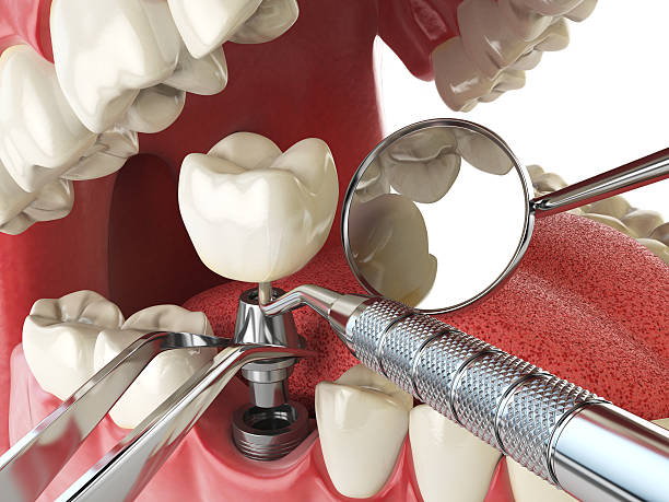 Best Emergency Tooth Extraction  in Alexandria, VA